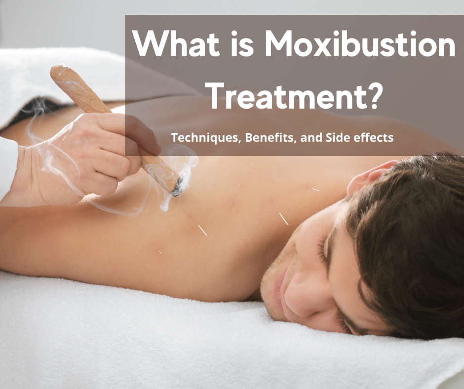 Moxibustion Treatment